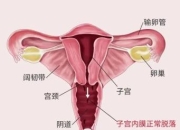 痛经遇到克星？这类痛经可能是子宫内膜异位症，别不当回事